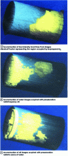 Figure 6 - Three-dimensional static reconstruction of multi-slice NMR images selecting fluids in a sandstone sample containing alcohol, water and oil. The flow direction is from right to left; the gray area shows the extent of the central part (after ).