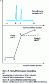 Figure 4 - Thermogram shapes