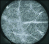 Figure 4 - Epifluorescent imaging of corneocytes directly on the skin