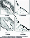 Figure 2 - PIXE microanalysis of a transverse section of placental artery (from [144])