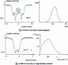 Figure 19 - Mössbauer spectra and hyperfine parameter distributions of amorphous Fe alloy 80Er4B16[35]