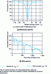 Figure 2 - Simulation of Mössbauer and NFS spectra for a single line (from )