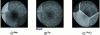 Figure 22 - Ion images on a Ni-based alloy. Intergranular carbon segregation. Illustration of the contrast effect