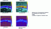 Figure 23 - Ion images (ToF-SIMS, primary Bi3 , 25 keV, secondary postacceleration) of a rat brain section (gyrus dentatus region )[37]