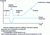 Figure 7 - Typical sequence (MS)2