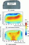 Figure 10 - Stress maps (in MPa) for a section of worn rail [7].