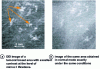 Figure 24 - Comparison between a radiograph of a breast tumor area obtained in conventional mode (b ) and in DEI mode (a ) [48]