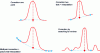 Figure 16 - Examples of different background correction procedures