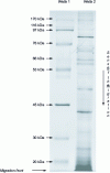 Figure 2 - Example of a 1D gel