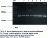 Figure 1 - Quality control of 302 bp PCR amplification products (columns 1 to 7)