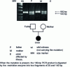 Figure 8 - Searching for the parental origin of a point mutation after enzymatic digestion of the PCR amplification product