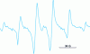 Figure 6 - EPR spectrum of polyethylene subjected to accelerated electrons at low temperature in the absence of oxygen