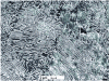 Figure 35 - Observation of a pearlitic steel microstructure