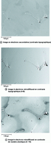 Figure 6 - Solidification dendritic structure of a stainless steel with tungsten carbide precipitation