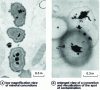 Figure 28 - Transmitted electron observation of mineral concretions after methyl-mercury poisoning