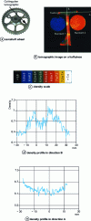 Figure 20 - Examination of a sintered steel camshaft wheel showing areas of density inhomogeneity quantified following calibration on standard disks (doc. PSA, COFREND collaboration).