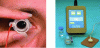 Figure 9 - Example of Eyegate® Pharma ocular iontophoresis system