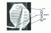 Figure 32 - Resistive divider