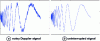 Figure 29 - Doppler signal denoising