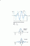 Figure 23 - DFT of a sinusoidal signal weighted by a Hanning window. Comparison with the DFT of the same truncated signal