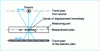 Figure 12 - Diagram of a contrast enhancement method for a measurement plane orthogonal to the X-ray emission direction