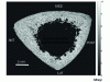 Figure 18 - 50 MHz acoustic image of a cross-section of the diaphysis of a human tibia (courtesy of Kay Raum, Charité – Universitätsmedizin Berlin). Full measurement parameters are given in [10].