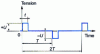 Figure 22 - Bipolar pulses