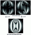 Figure 19 - Diametrically compressed disc: rectilinear dark-field polariscope for two orientations of the polarizer-analyzer assembly (a), (b) and circular polariscope (c)