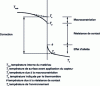 Figure 23 - Diagram of the relative weights of parasitic errors in direct measurement