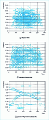 Figure 6 - Wigner-Ville, pseudo-Wigner-Ville and log-smoothed pseudo-Wigner-Ville transforms