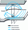 Figure 1 - Different types of transmission available with a vertical joint [19]