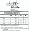 Figure 7 - Study of vibration levels on sanders