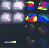 Figure 42 - (a) Four cineholograms of a car door that has just been slammed shut, (b) Deformations measured from the cineholograms, (c) Pseudo-3d representations of the deformations (doc.HOLO3)