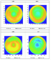 Figure 8 - Measured surfaces of the LAM sphere after subtraction of the best sphere (Credit CNRS)