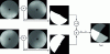 Figure 13 - Creation of the image containing information on the orientation of the normals according to the four quadrants: the Iquad image has only four levels of gray.