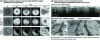 Figure 22 - High-resolution Fourier-domain OCM imaging
(Credit Karnowski et al., and Marchand et al.)