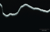 Figure 25 - Spectral-domain OCT image of a bacterial
biofilm forming on the water surface