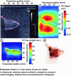 Figure 14 - Complementarity
between B-mode ultrasound measurement (a) and acousto-optical imaging
(b) (Credit Journal of Biophotonics)