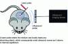 Figure 5 - Principle of photo-acoustic imaging
for biological imaging