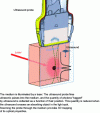 Figure 8 - Basic principle of acousto-optical
imaging