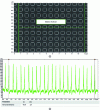 Figure 6 - Example of the manual evaluation of an average network pitch from: (a) an image and (b) a profile (Mountains Lab ®, Digital Surf)