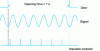 Figure 13 - Pulse counting for 1 second