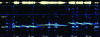 Figure 7 - Sonogram of an LFAS emission simultaneous
with a whale song [11].