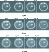 Figure 19 - Image reconstruction of the Terakenstein sample at position cut y = 25 using sinograms with 9, 12, 18, and 36 projections and the BFP, SART and OSEM methods.