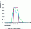 Figure 24 - Comparison of horizontal intensity profiles of a metal bar obtained with SART and optimized SART