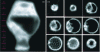 Figure 23 - (a) THz image of pottery in inverted position (Ancient Egypt, inventory number 8608). Markers 1 to 9 indicate the positions of the axial sections visible in (b). Image size: ...