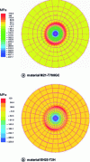 Figure 11 - Normal stress fields σ33 for machining conditions with three folds under the drill and Fz = 730 N