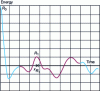 Figure 2 - Demodulated signal autocorrelogram representation of Gaussian noise