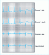 Figure 5 - Part of recording 124 from the Arrhythmia database, showing normal beats as well as ventricular extrasystoles. We can see that compression fidelity is very high for both types of beats