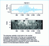 Figure 6 - Oscillometric data and corresponding discrete wavelet transform (bottom)